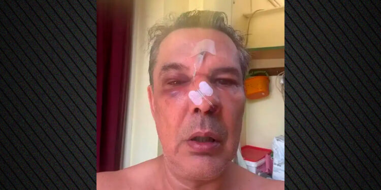 Άγριος ξυλοδαρμός σε ιατρείο στο Χαϊδάρι: Του έκανε παρατήρηση για το κινητό και κατέληξε με κάταγμα στη μύτη